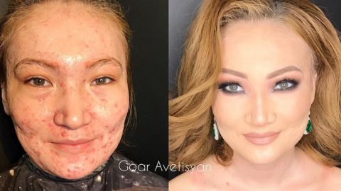 خبيرة تجميل روسية بقدرات جراحين التجميل