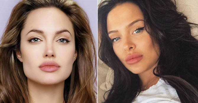 شبيهة أنجلينا جولي تزداد شهرة بعد مرضها
