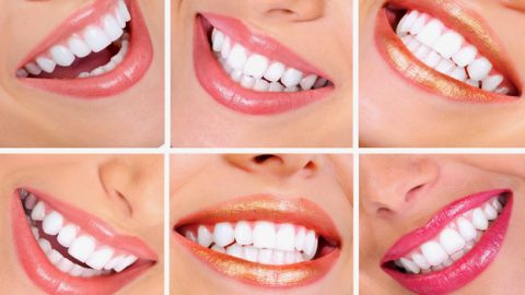 كيف تتجنبي اصفرار الأسنان