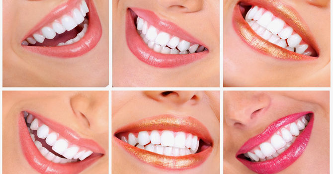 كيف تتجنبي اصفرار الأسنان