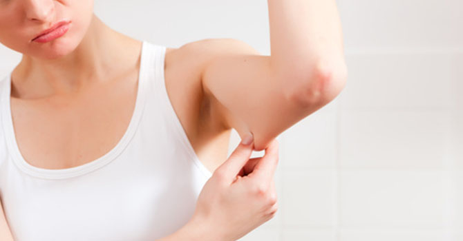 إليكِ الحل المثالي لشد ترهلات الذراعين