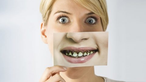 الصودا الخالية من السكر حمية تضر أسنانك