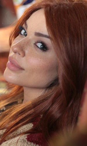نادين نجيم بشعر احمر ونمش صناعي في مسلسل نص يوم