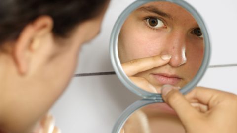 5 وسائل للتخلص من البثور بين عشية وضحاها