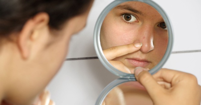 5 وسائل للتخلص من البثور بين عشية وضحاها