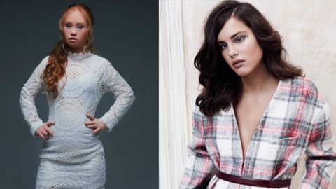 عارضات أزياء نجحوا رغم الإعاقة بعام 2015