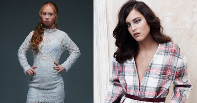 عارضات أزياء نجحوا رغم الإعاقة بعام 2015