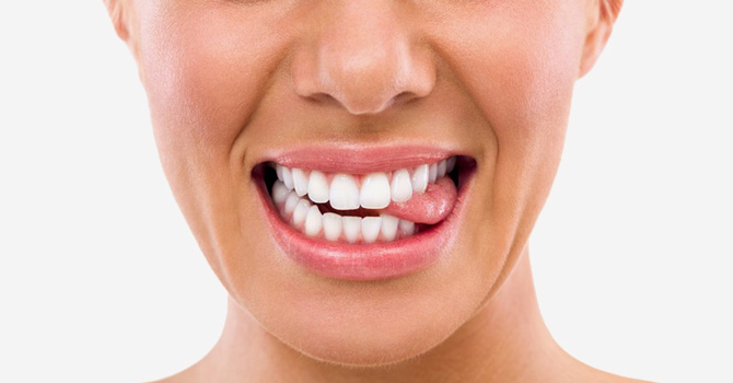 أشياء يجب أن تعرفيها قبل تبييض أسنانك