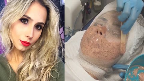 مدونة تجميل تستعين بالقناع الخانق للتخلص من سموم البشرة