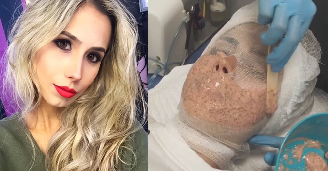 مدونة تجميل تستعين بالقناع الخانق للتخلص من سموم البشرة