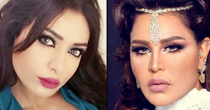 كاميليا ورد تهاجم أحلام من جديد .. فما السبب؟