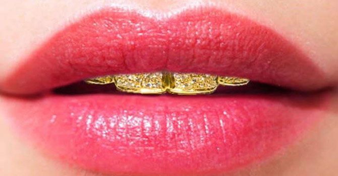 أغلى إبتسامة في العالم من دبي بقيمة 153 ألف دولار