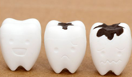 أهم مشكلات الأسنان ونصائح علاجها