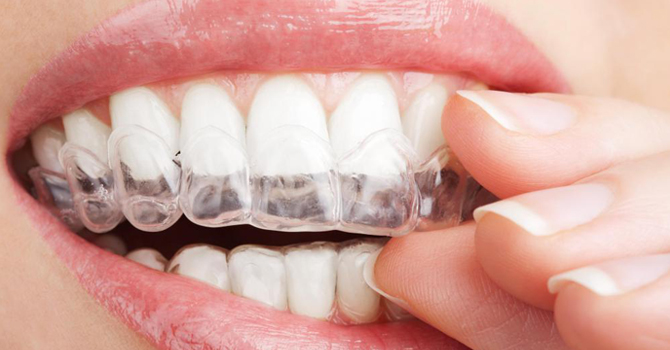 5 نصائح لأسنان ناصعة البياض