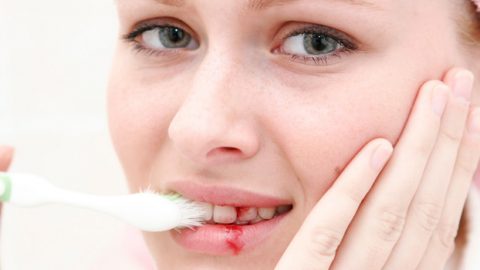 أسباب تصيب اللثة بالنزيف وتحرمك من الابتسامة المثالية