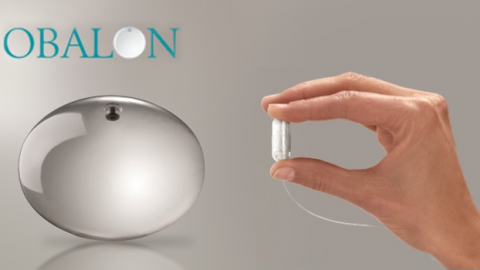 Obalon أبرز صيحات خسارة الوزن في 2014