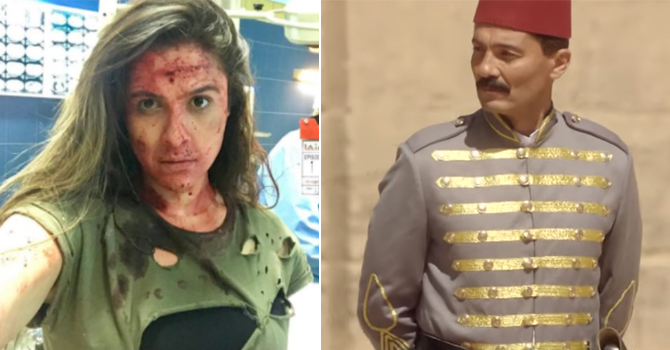 الدراما المصرية في ورطة بسبب إصابات النجوم
