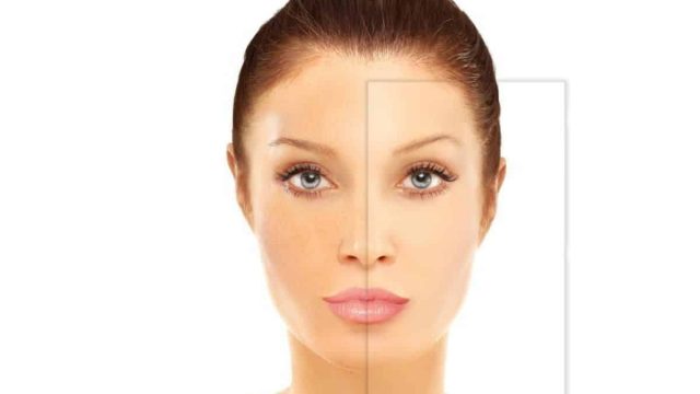 تعرفي إلى أهم المنتجات الي تحتاجها كل بشرة دهنية