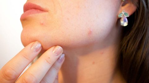 اكتشفي أعراض الحساسية من مستحضرات التجميل وأهم مسبباتها