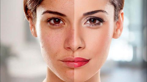 طرق تفتيح البشرة من اسمرار الشمس في الصيف