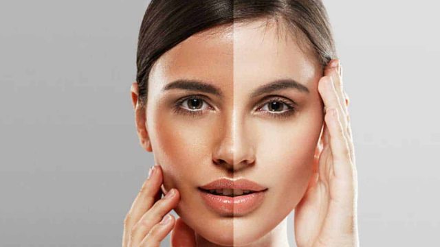 وصفات طبيعية لتبييض البشرة سهلة التحضير وسريعة النتائج