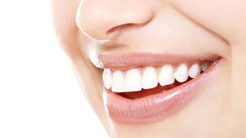 أفضل الوصفات لتبييض الأسنان لابتسامة ساحرة