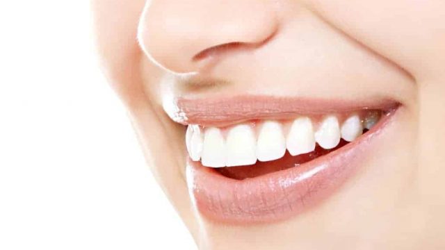أفضل الوصفات لتبييض الأسنان لابتسامة ساحرة