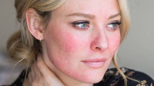 أفضل المستحضرات لترطيب البشرة الحساسة