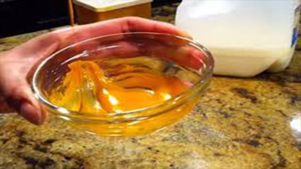 ترهلات الرقبة