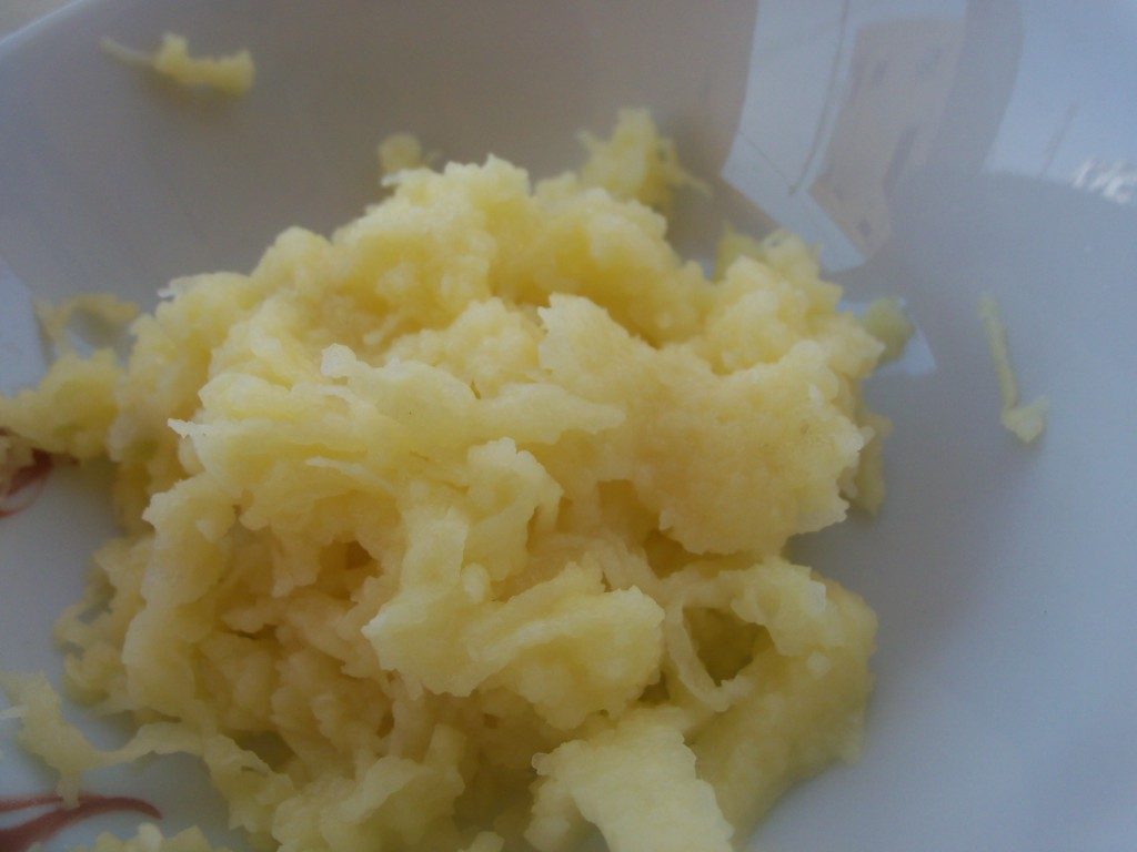 ترهلات الرقبة