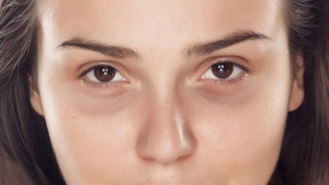 دليلك الشامل للتعامل مع جيوب العين والهالات السوداء!