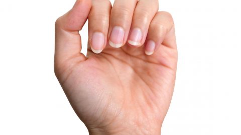 هل اصفرار اليدين يعد إشارة لوجود مشاكل صحية؟