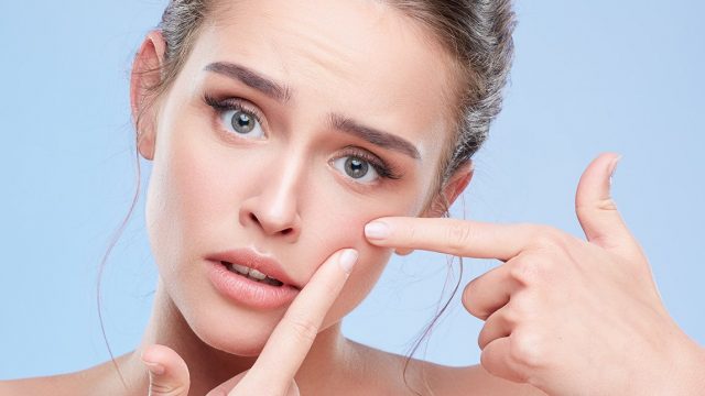 علاج بثور الوجه : طرق بسيطة تخلصك من حب الشباب سريعًا